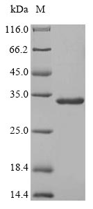 SAA1 / SAA / Serum Amyloid A Protein - (Tris-Glycine gel) Discontinuous SDS-PAGE (reduced) with 5% enrichment gel and 15% separation gel.