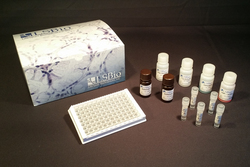 SHBG ELISA Kit