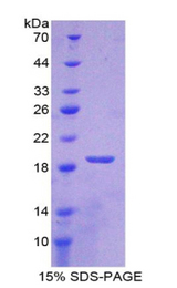 SOD1 / Cu-Zn SOD Protein - Recombinant Superoxide Dismutase 1, Soluble By SDS-PAGE