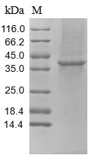 TFPI / LACI Protein - (Tris-Glycine gel) Discontinuous SDS-PAGE (reduced) with 5% enrichment gel and 15% separation gel.