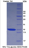 THBD / CD141 / Thrombomodulin Protein - Recombinant Thrombomodulin (TM) by SDS-PAGE