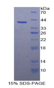VCAM1 / CD106 Protein - Recombinant Vascular Cell Adhesion Molecule 1 By SDS-PAGE