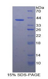 VCAM1 / CD106 Protein - Recombinant Vascular Cell Adhesion Molecule 1 By SDS-PAGE