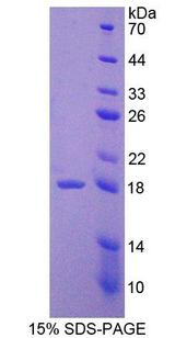 VEGFA / VEGF Protein - Recombinant Vascular Endothelial Growth Factor A By SDS-PAGE