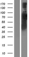 RABEP1 / Rabaptin-5 Protein - Western validation with an anti-DDK antibody * L: Control HEK293 lysate R: Over-expression lysate