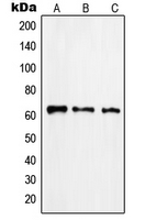 RABEP2 Antibody - Western blot analysis of Rabaptin 5 beta expression in Jurkat (A); HUVEC (B); human pancreas (C) whole cell lysates.