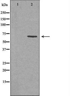 RABEP2 Antibody - Western blot analysis of extracts of HeLa cells using RABEP2 antibody. The lane on the left is treated with the antigen-specific peptide.