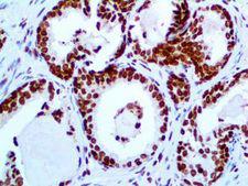 RABEPK / p40 Antibody - IHC of p40 on an FFPE Prostate Tissue