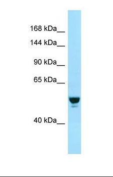 RABGAP1 Antibody - Western blot of Human Fetal Lung. RABGAP1 antibody dilution 1.0 ug/ml.  This image was taken for the unconjugated form of this product. Other forms have not been tested.