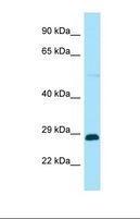 RABGAP1L Antibody - Western blot of Human HT1080. RABGAP1L antibody dilution 1.0 ug/ml.  This image was taken for the unconjugated form of this product. Other forms have not been tested.