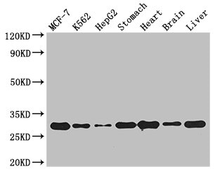 RABGAP1L Antibody - Western Blot Positive WB detected in:MCF-7 whole cell lysate,K562 whole cell lysate,HepG2 whole cell lysate,Mouse stomach tissue,Mouse heart tissue,Mouse brain tissue,Mouse liver tissue All Lanes: RABGAP1L antibody at 3ug/ml Secondary Goat polyclonal to rabbit IgG at 1/50000 dilution Predicted band size: 30 kDa Observed band size: 30 kDa