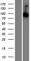 RABGAP1L Protein - Western validation with an anti-DDK antibody * L: Control HEK293 lysate R: Over-expression lysate