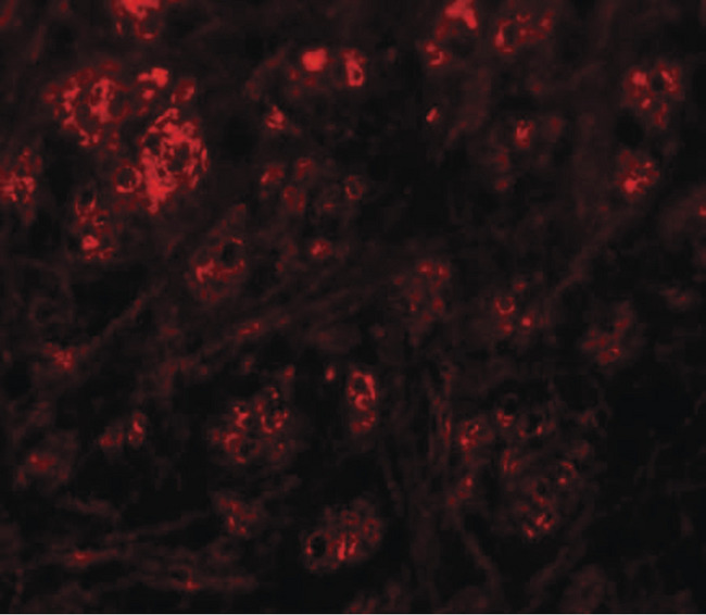 RABGEF1 Antibody - Immunofluorescence of RABEX5 in mouse brain tissue with RABEX5 antibody at 20 ug/ml.