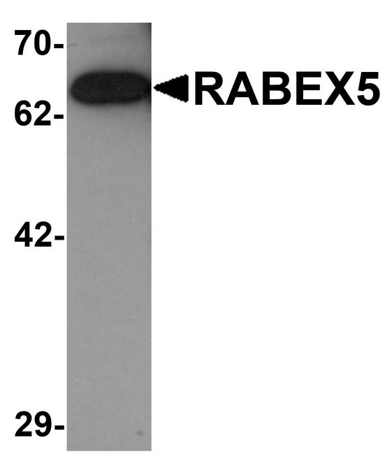 RABGEF1 Antibody - Western blot analysis of RABEX5 in rat brain tissue lysate with RABEX5 antibody at 1 ug/ml.