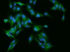 RABGEF1 Antibody - Immunofluorescence staining of RABGEF1 in U251MG cells. Cells were fixed with 4% PFA, permeabilzed with 0.1% Triton X-100 in PBS, blocked with 10% serum, and incubated with rabbit anti-Human RABGEF1 polyclonal antibody (dilution ratio 1:200) at 4°C overnight. Then cells were stained with the Alexa Fluor 488-conjugated Goat Anti-rabbit IgG secondary antibody (green) and counterstained with DAPI (blue). Positive staining was localized to Cytoplasm.