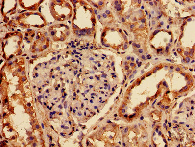 RABGGTA Antibody - IHC image of RABGGTA Antibody diluted at 1:150 and staining in paraffin-embedded human kidney tissue performed on a Leica BondTM system. After dewaxing and hydration, antigen retrieval was mediated by high pressure in a citrate buffer (pH 6.0). Section was blocked with 10% normal goat serum 30min at RT. Then primary antibody (1% BSA) was incubated at 4°C overnight. The primary is detected by a biotinylated secondary antibody and visualized using an HRP conjugated SP system.