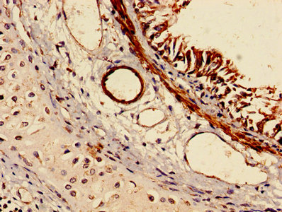 RABGGTA Antibody - IHC image of RABGGTA Antibody diluted at 1:150 and staining in paraffin-embedded human lung tissue performed on a Leica BondTM system. After dewaxing and hydration, antigen retrieval was mediated by high pressure in a citrate buffer (pH 6.0). Section was blocked with 10% normal goat serum 30min at RT. Then primary antibody (1% BSA) was incubated at 4°C overnight. The primary is detected by a biotinylated secondary antibody and visualized using an HRP conjugated SP system.