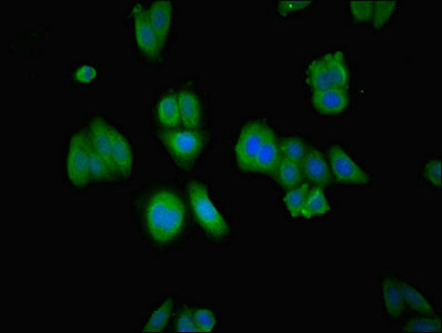 RABGGTA Antibody - Immunofluorescent analysis of HepG2 cells using RABGGTA Antibody at dilution of 1:100 and Alexa Fluor 488-congugated AffiniPure Goat Anti-Rabbit IgG(H+L)