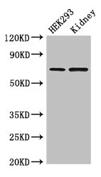 RABGGTA Antibody - Western Blot Positive WB detected in: HEK293 whole cell lysate, Mouse kidney tissue All lanes: RABGGTA antibody at 1.5µg/ml Secondary Goat polyclonal to rabbit IgG at 1/50000 dilution Predicted band size: 66 kDa Observed band size: 66 kDa