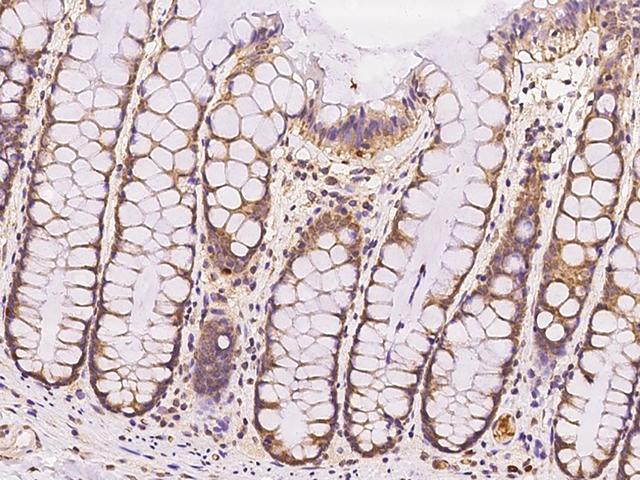 RABGGTA Antibody - Immunochemical staining of human RABGGTA in human rectum with rabbit polyclonal antibody at 1:100 dilution, formalin-fixed paraffin embedded sections.