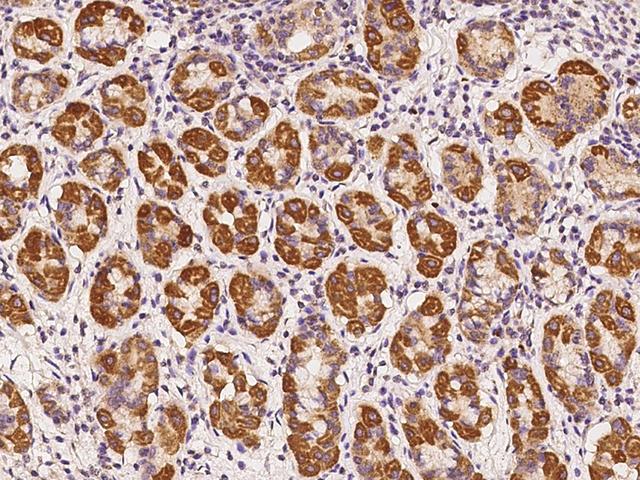 RABGGTA Antibody - Immunochemical staining of human RABGGTA in human stomach with rabbit polyclonal antibody at 1:100 dilution, formalin-fixed paraffin embedded sections.