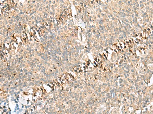 RABGGTA Antibody - Immunohistochemistry of paraffin-embedded Human tonsil tissue  using RABGGTA Polyclonal Antibody at dilution of 1:50(×200)