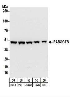 RABGGTB Antibody - Detection of Human and Mouse RABGGTB by Western Blot. Samples: Whole cell lysate (50 ug) from HeLa, 293T, Jurkat, mouse TCMK-1, and mouse NIH3T3 cells. Antibodies: Affinity purified rabbit anti-RABGGTB antibody used for WB at 0.1 ug/ml. Detection: Chemiluminescence with an exposure time of 30 seconds.