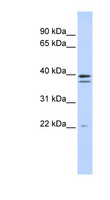 RABGGTB Antibody - RABGGTB antibody Western blot of Fetal Brain lysate. This image was taken for the unconjugated form of this product. Other forms have not been tested.