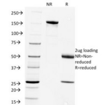Rabies Virus Antibody - SDS-PAGE Analysis of Purified, BSA-Free Rabies Virus Antibody (clone Rab-50). Confirmation of Integrity and Purity of the Antibody.