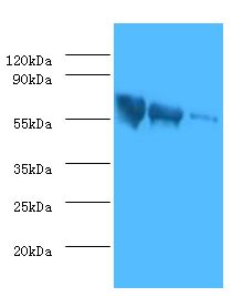 Rabies Virus gG Antibody - Western blot. All lanes: Rabies virus Glycoprotein G antibody at 1:500. Lane 1:Rabies virus antigen 1:2 Lane 2: Rabies virus antigen 1:10 Lane 3: Rabies virus antigen 1:20. Secondary antibody: Goat polyclonal to rabbit at 1:10000 dilution.