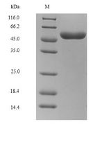 Rabies Virus gG Protein - (Tris-Glycine gel) Discontinuous SDS-PAGE (reduced) with 5% enrichment gel and 15% separation gel.
