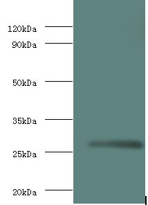 Rabies Virus Matrix Protein Antibody - western blot All lanes: Matrix protein antibody at 2 ug/ml+recombinant Matrix protein 0.1ug. Secondary antibody: Goat polyclonal to Rabbit IgG at 1:10000 dilution. Predicted band size: 23 kDa. Observed band size: 23 kDa.  This image was taken for the unconjugated form of this product. Other forms have not been tested.