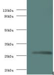 Rabies Virus Matrix Protein Antibody - western blot All lanes: Matrix protein antibody at 2 ug/ml+recombinant Matrix protein 0.1ug. Secondary antibody: Goat polyclonal to Rabbit IgG at 1:10000 dilution. Predicted band size: 23 kDa. Observed band size: 23 kDa.  This image was taken for the unconjugated form of this product. Other forms have not been tested.