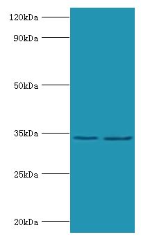 Rabies Virus Phosphoprotein Antibody - western blot All lanes: Phosphoprotein antibody at 2 ug/ml Lane 1:Rabies virus Phosphoprotein protein at 1ug. Lane 2: Rabies virus Phosphoprotein protein at 0.1ug. Secondary antibody: Goat polyclonal to rabbit at 1:10000 dilution. Predicted band size: 34 kDa. Observed band size 4 kDa.  This image was taken for the unconjugated form of this product. Other forms have not been tested.