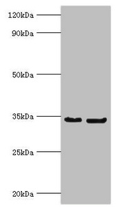 Rabies Virus Phosphoprotein Antibody - Western blot All lanes: Phosphoprotein antibody at 2µg/ml Lane 1: Rabies virus Phosphoprotein protein at 1µg Lane 2: Rabies virus Phosphoprotein protein at 0.1µg Secondary Goat polyclonal to rabbit IgG at 1/10000 dilution Predicted band size: 34, 32, 28, 26, 25 kDa Observed band size: 34 kDa