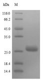 SARS-CoV Matrix Protein - (Tris-Glycine gel) Discontinuous SDS-PAGE (reduced) with 5% enrichment gel and 15% separation gel.