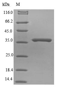 SARS-CoV Matrix Protein - (Tris-Glycine gel) Discontinuous SDS-PAGE (reduced) with 5% enrichment gel and 15% separation gel.