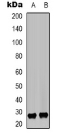 RABL2A Antibody - Western blot analysis of RABL2A expression in Jurkat (A); HEK293T (B) whole cell lysates.
