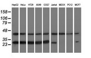 RABL2A Antibody - Western blot of extracts (35 ug) from 9 different cell lines by using anti-RABL2A monoclonal antibody.