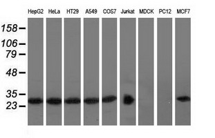 RABL2A Antibody - Western blot analysis of extracts (35ug) from 9 different cell lines by using anti-RABL2A monoclonal antibody.