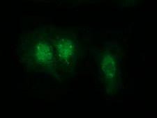 RABL2A Antibody - Anti-RABL2A mouse monoclonal antibody  immunofluorescent staining of COS7 cells transiently transfected by pCMV6-ENTRY RABL2A.
