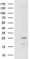 RABL2A Antibody - HEK293T cells were transfected with the pCMV6-ENTRY control (Left lane) or pCMV6-ENTRY RABL2A (Right lane) cDNA for 48 hrs and lysed. Equivalent amounts of cell lysates (5 ug per lane) were separated by SDS-PAGE and immunoblotted with anti-RABL2A.