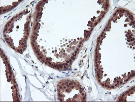 RABL2A Antibody - IHC of paraffin-embedded Human breast tissue using anti-RABL2A mouse monoclonal antibody.