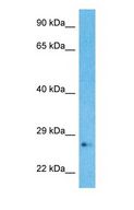 RABL2A Antibody - Western blot of RBL2A Antibody with human MCF7 Whole Cell lysate.  This image was taken for the unconjugated form of this product. Other forms have not been tested.
