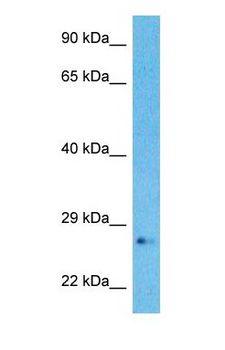 RABL2A Antibody - Western blot of RBL2A Antibody with human MCF7 Whole Cell lysate.  This image was taken for the unconjugated form of this product. Other forms have not been tested.