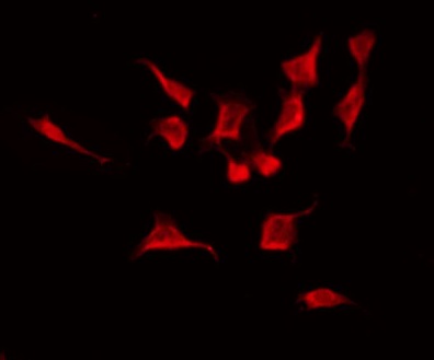 RABL2A Antibody - Staining HuvEc cells by IF/ICC. The samples were fixed with PFA and permeabilized in 0.1% Triton X-100, then blocked in 10% serum for 45 min at 25°C. The primary antibody was diluted at 1:200 and incubated with the sample for 1 hour at 37°C. An Alexa Fluor 594 conjugated goat anti-rabbit IgG (H+L) Ab, diluted at 1/600, was used as the secondary antibody.