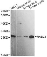 RABL3 Antibody - Western blot analysis of extracts of various cell lines, using RABL3 antibody at 1:3000 dilution. The secondary antibody used was an HRP Goat Anti-Rabbit IgG (H+L) at 1:10000 dilution. Lysates were loaded 25ug per lane and 3% nonfat dry milk in TBST was used for blocking. An ECL Kit was used for detection and the exposure time was 90s.