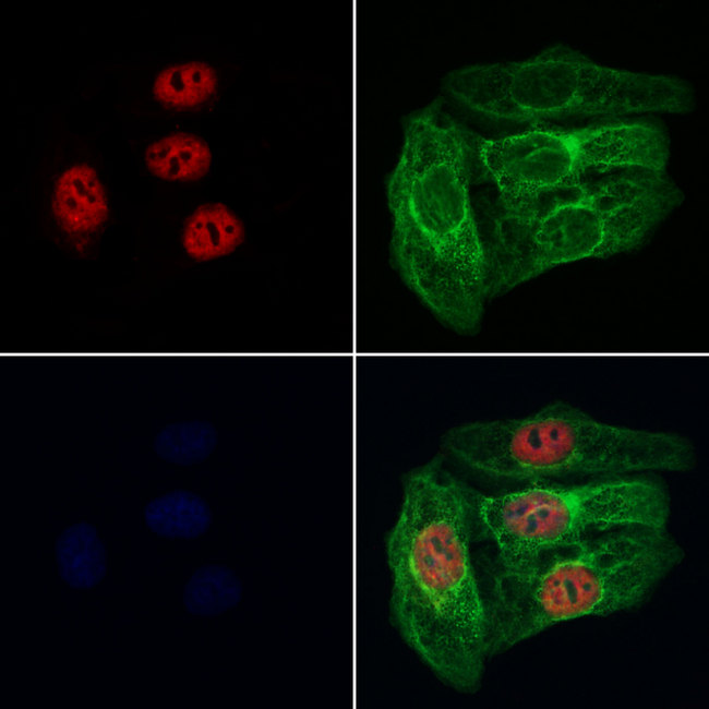 RABL3 Antibody - Staining HeLa cells by IF/ICC. The samples were fixed with PFA and permeabilized in 0.1% Triton X-100, then blocked in 10% serum for 45 min at 25°C. Samples were then incubated with primary Ab(1:200) and mouse anti-beta tubulin Ab(1:200) for 1 hour at 37°C. An AlexaFluor594 conjugated goat anti-rabbit IgG(H+L) Ab(1:200 Red) and an AlexaFluor488 conjugated goat anti-mouse IgG(H+L) Ab(1:600 Green) were used as the secondary antibod