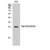 RAC1+2+3 + CDC42 Antibody - Western blot of Rac1/2/3/CDC42 antibody