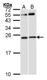 RAC1 Antibody - Sample (30 ug of whole cell lysate). A: Hela, B: Raji. 12% SDS PAGE. RAC1 antibody diluted at 1:1000.
